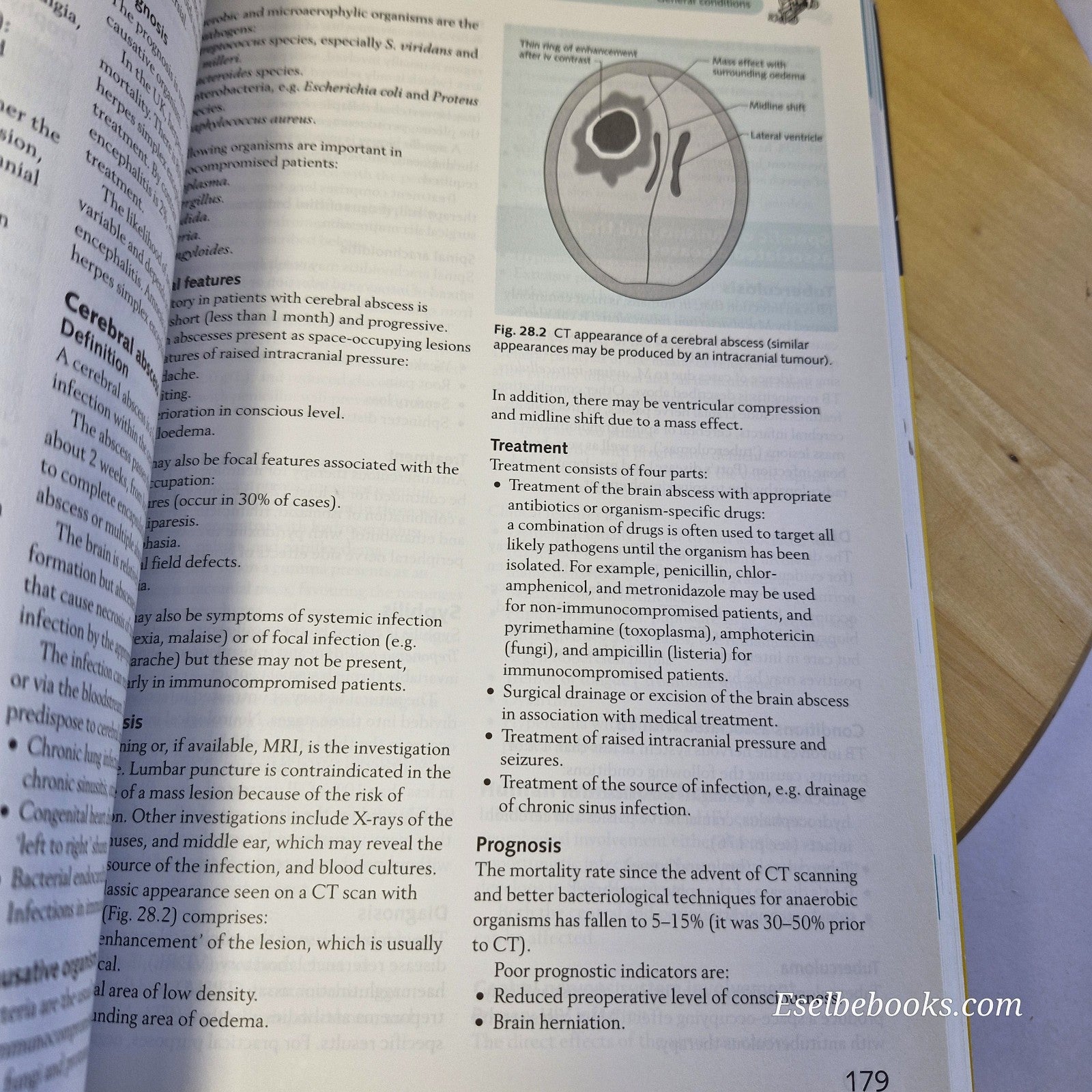Crash Course: Neurology 2nd Edition by Turner Bahra & Cikruel - paperback