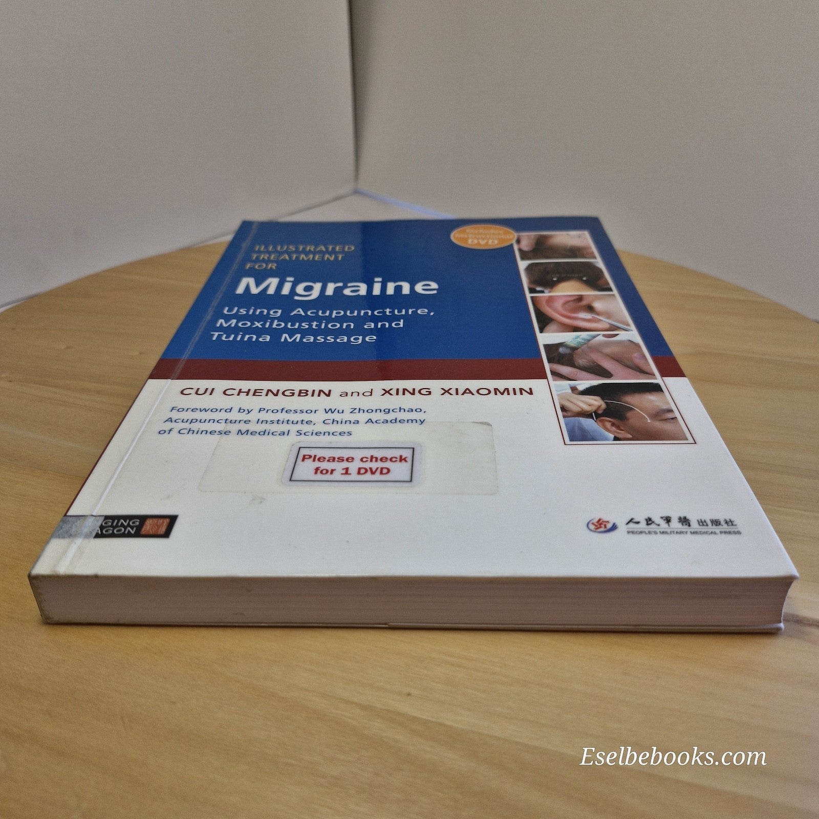 Illustrated Treatment for Migraine Using Acupuncture, Moxibustion and Tuina...