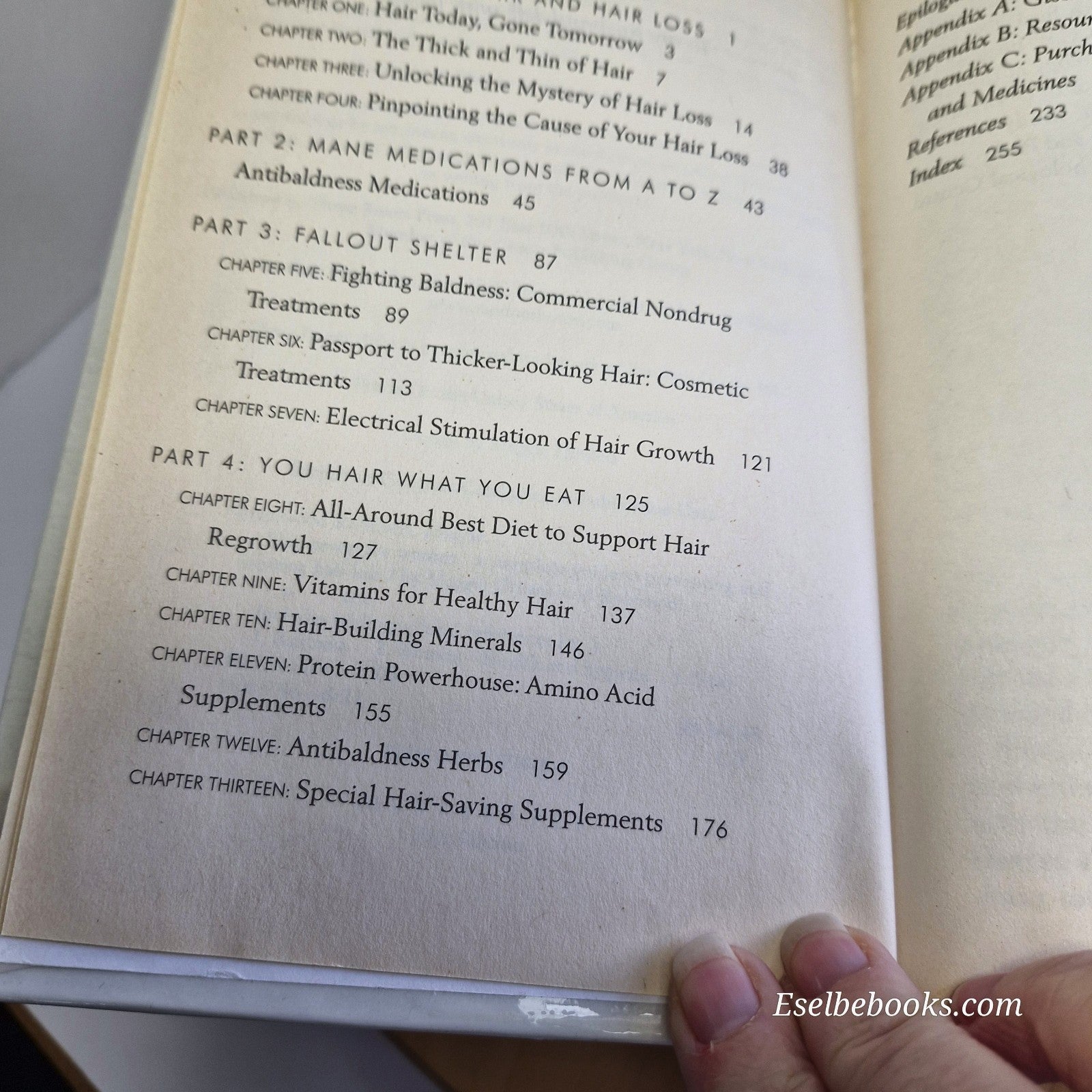 3 books about hair loss/alopecia - hardback/paperbacks