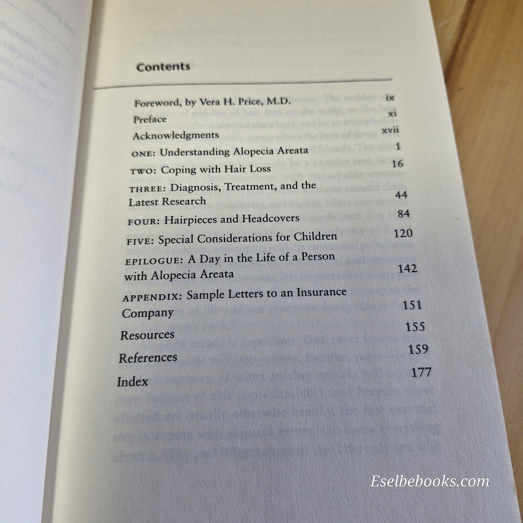 3 books about hair loss/alopecia - hardback/paperbacks