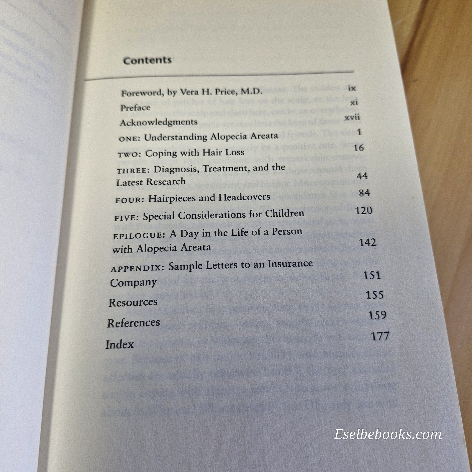 3 books about hair loss/alopecia - hardback/paperbacks