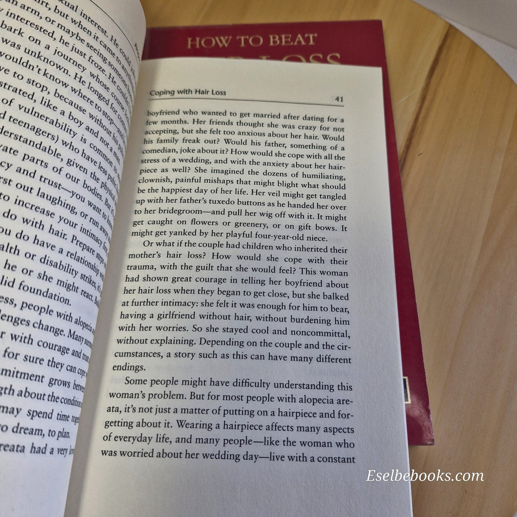 3 books about hair loss/alopecia - hardback/paperbacks