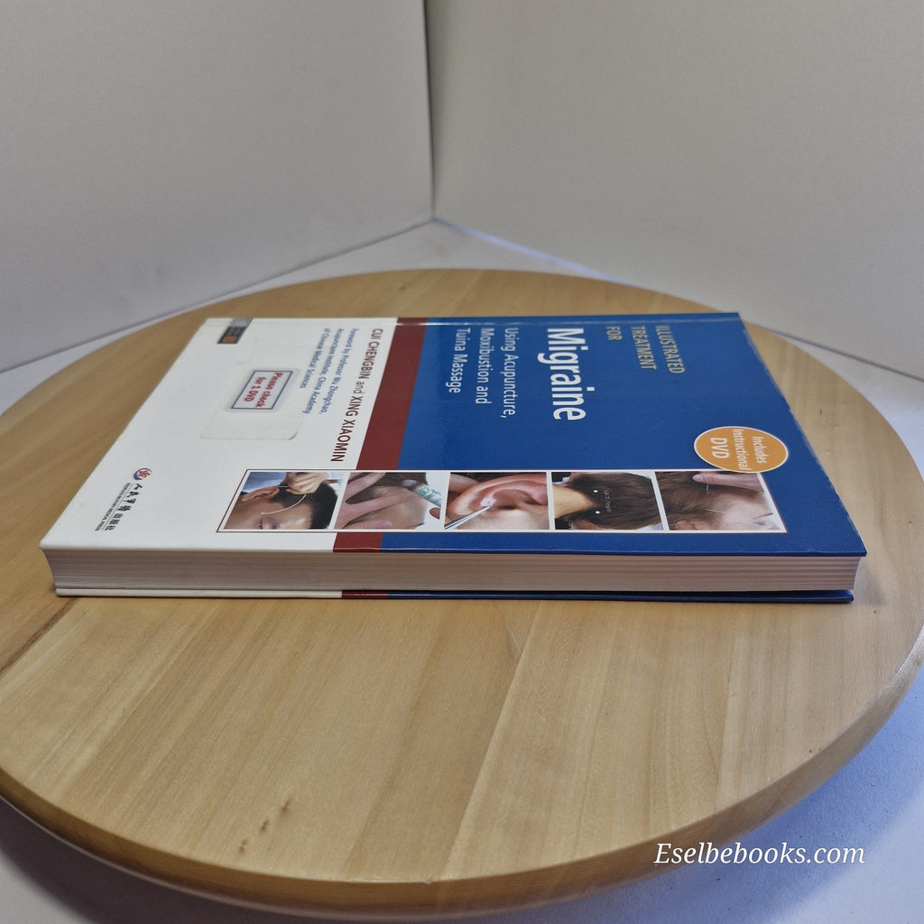 Illustrated Treatment for Migraine Using Acupuncture, Moxibustion and Tuina...