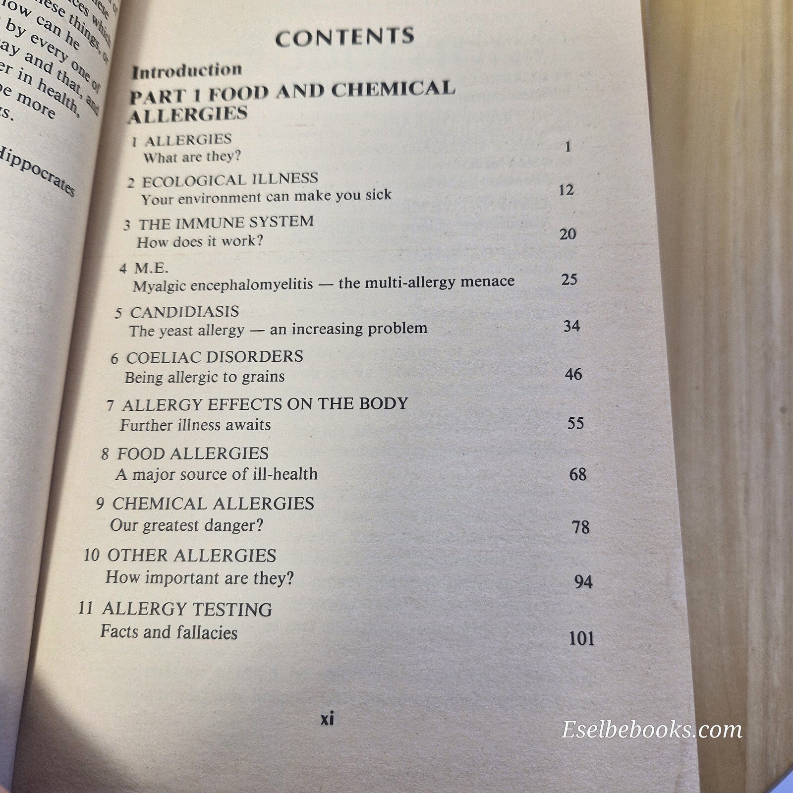 Health: 4 x  dealing with allergies books - paperbacks