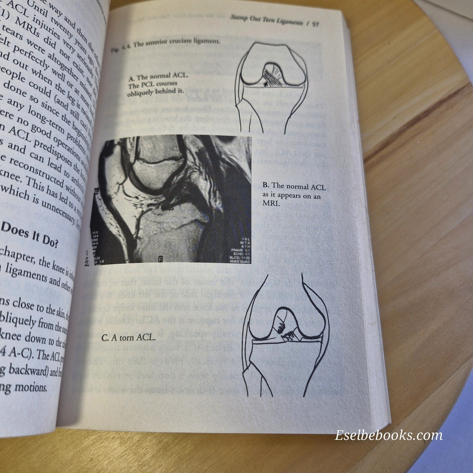 What Your Doctor May Not Tell You about Knee Pain and Surgery by Ron Grelsamer
