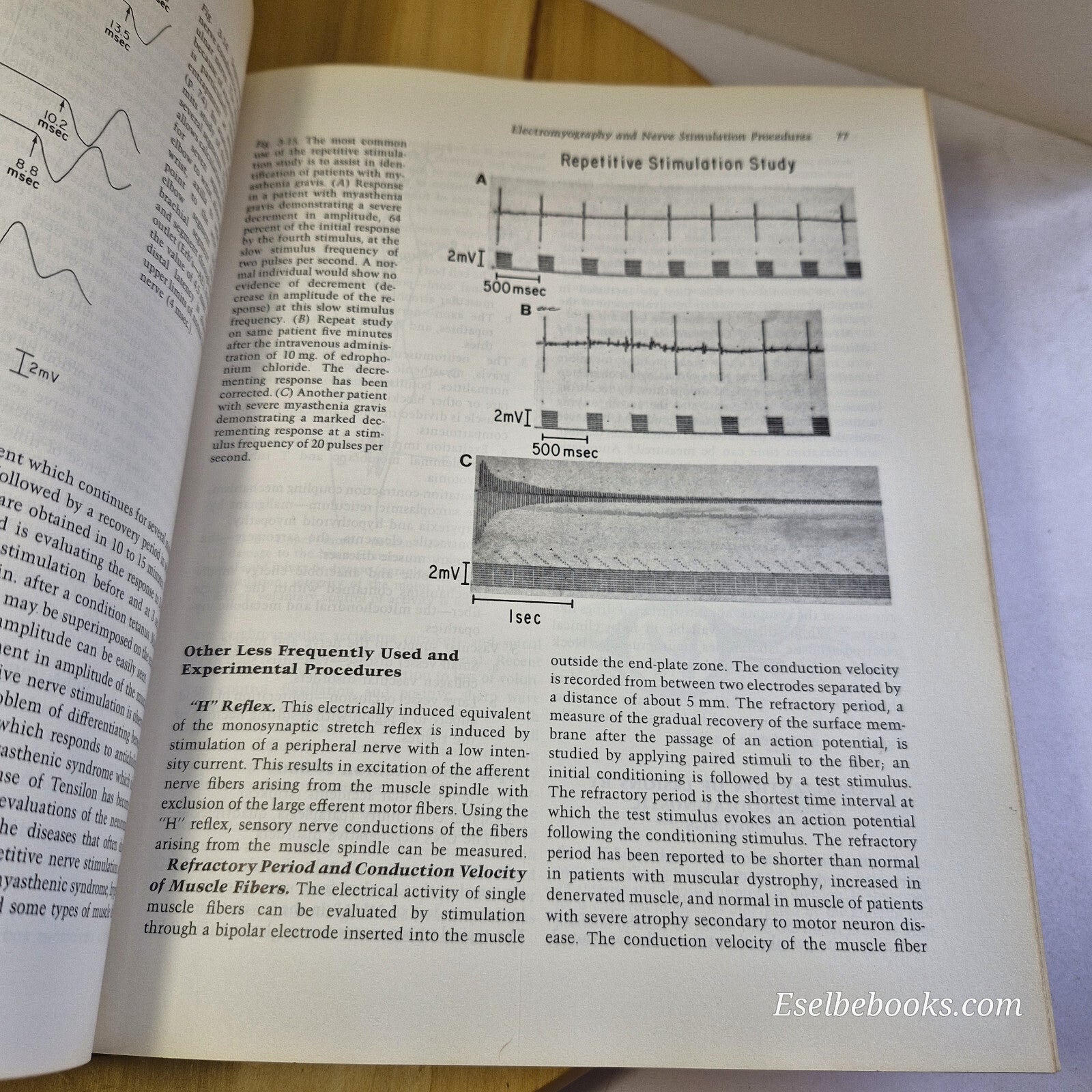 Musculoskeletal Disorders Regional Examination and Differential Diagnosis By ...