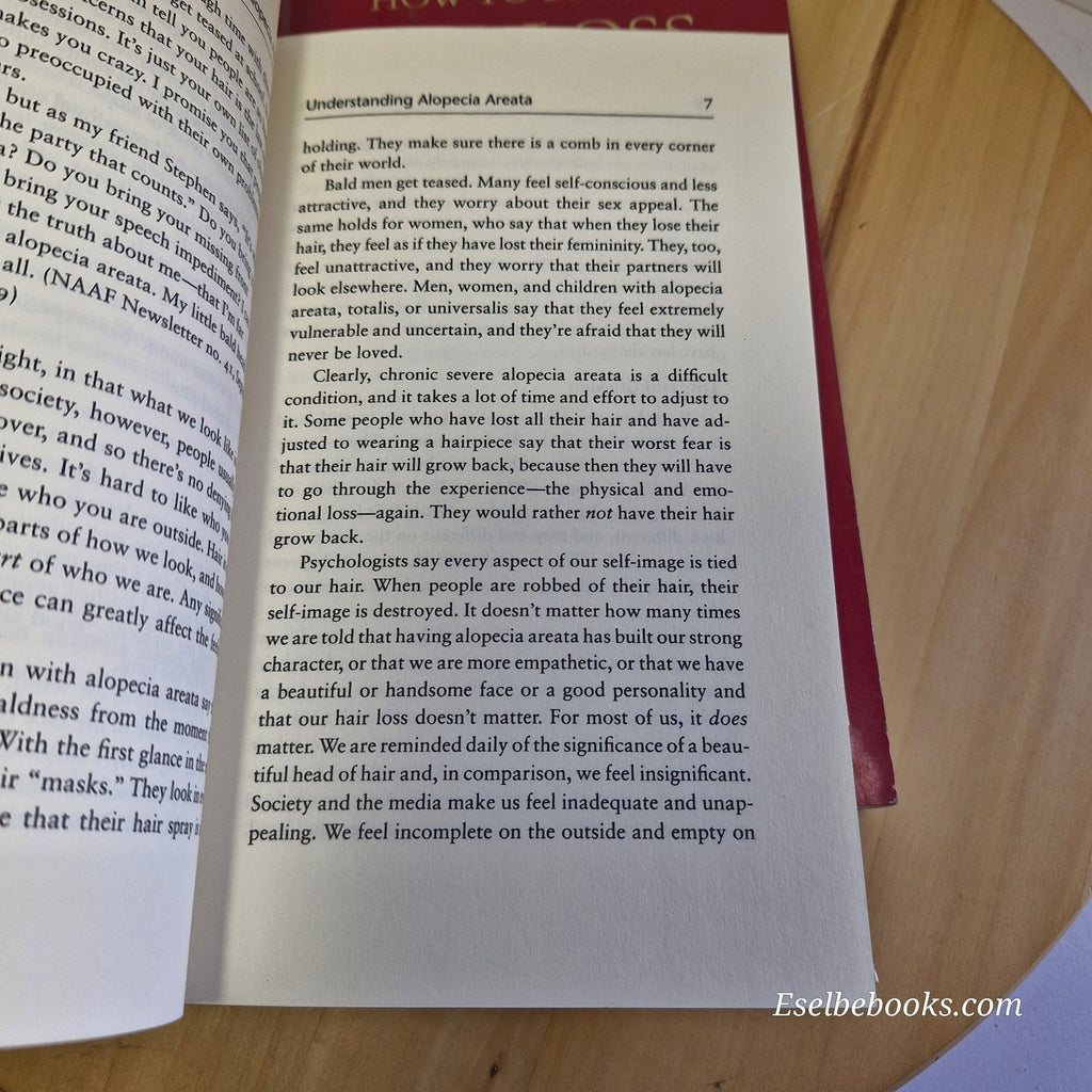 3 books about hair loss/alopecia - hardback/paperbacks