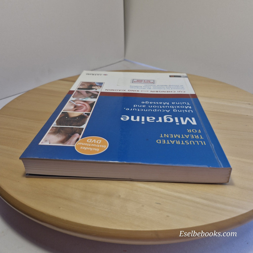 Illustrated Treatment for Migraine Using Acupuncture, Moxibustion and Tuina...