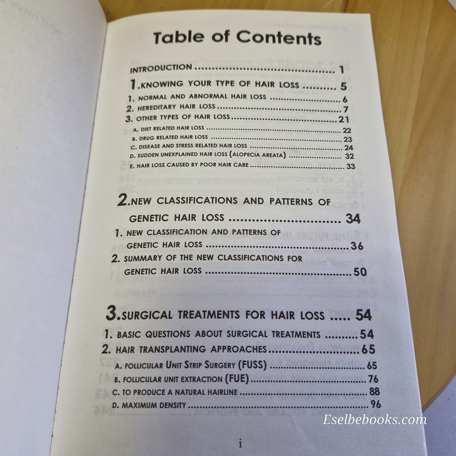 3 books about hair loss/alopecia - hardback/paperbacks