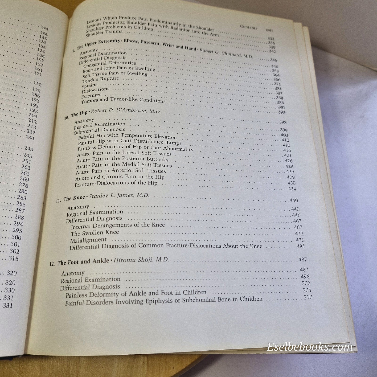 Musculoskeletal Disorders Regional Examination and Differential Diagnosis By ...