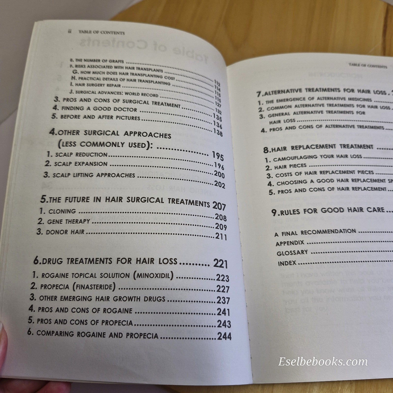 3 books about hair loss/alopecia - hardback/paperbacks