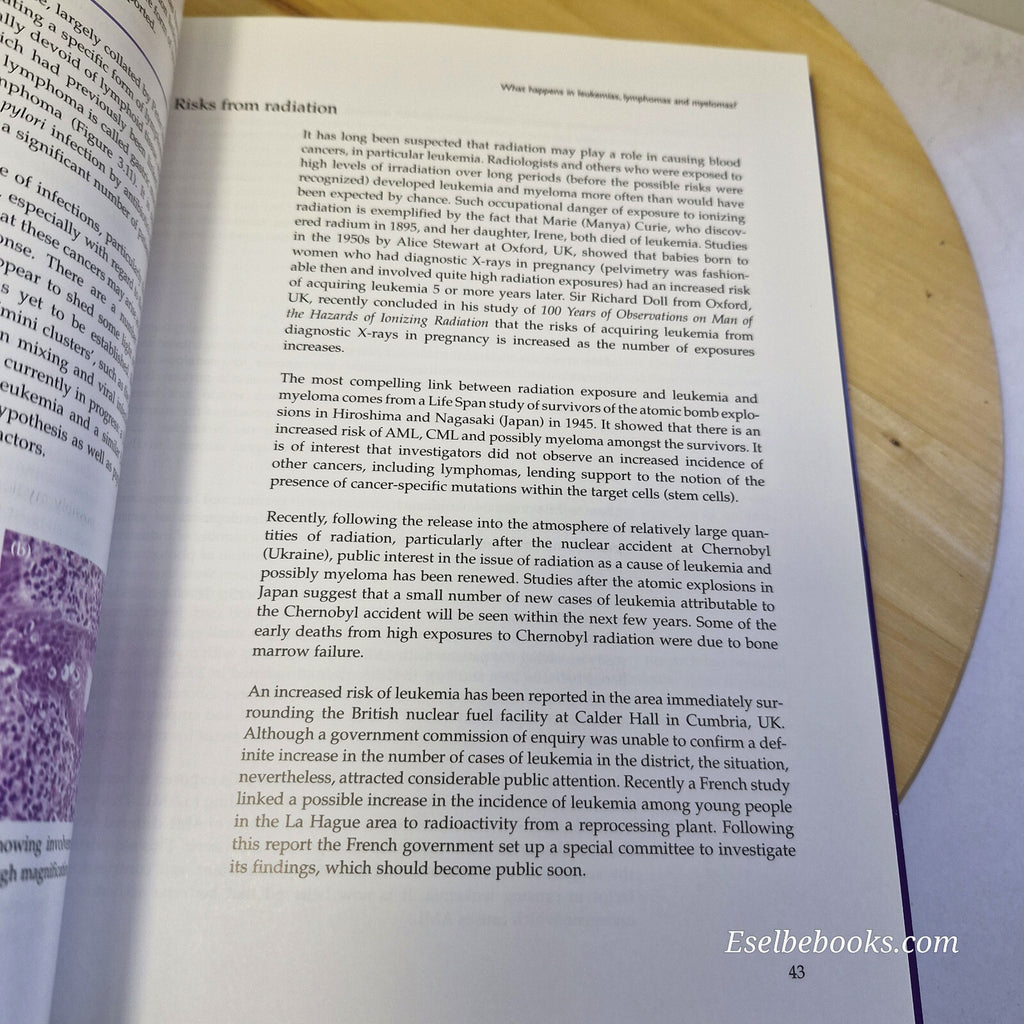 Understanding Leukemias, Lymphomas and Myelomas By Tariq Mughal, John Goldman...