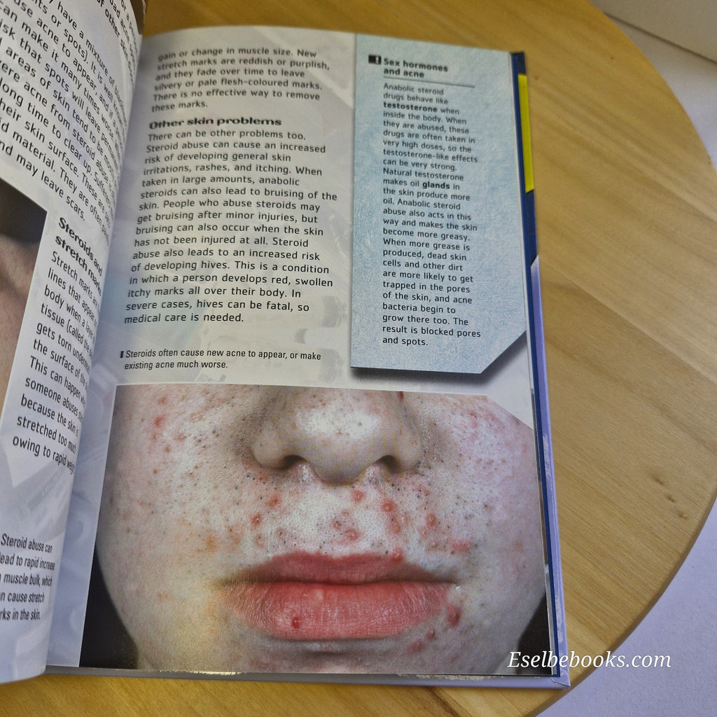 Steroids by Karla Fitzhugh (2005, Hardcover)