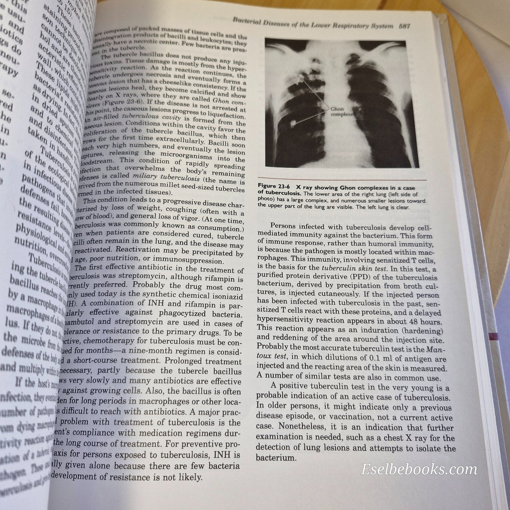 Microbiology - An Introduction - 3rd Edition Tortora/Runke/Case - Hardcover