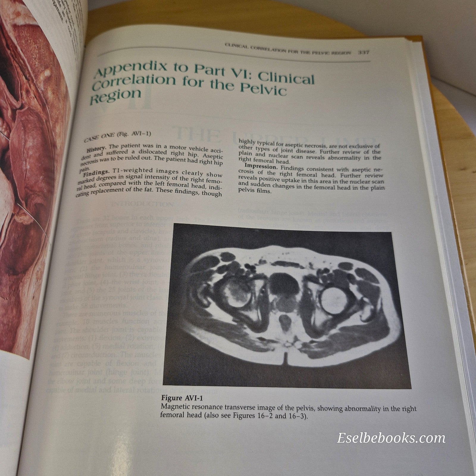 Modern Sectional Anatomy By Alexander Lane & Hossein Sharfaei · 1992 - hardback