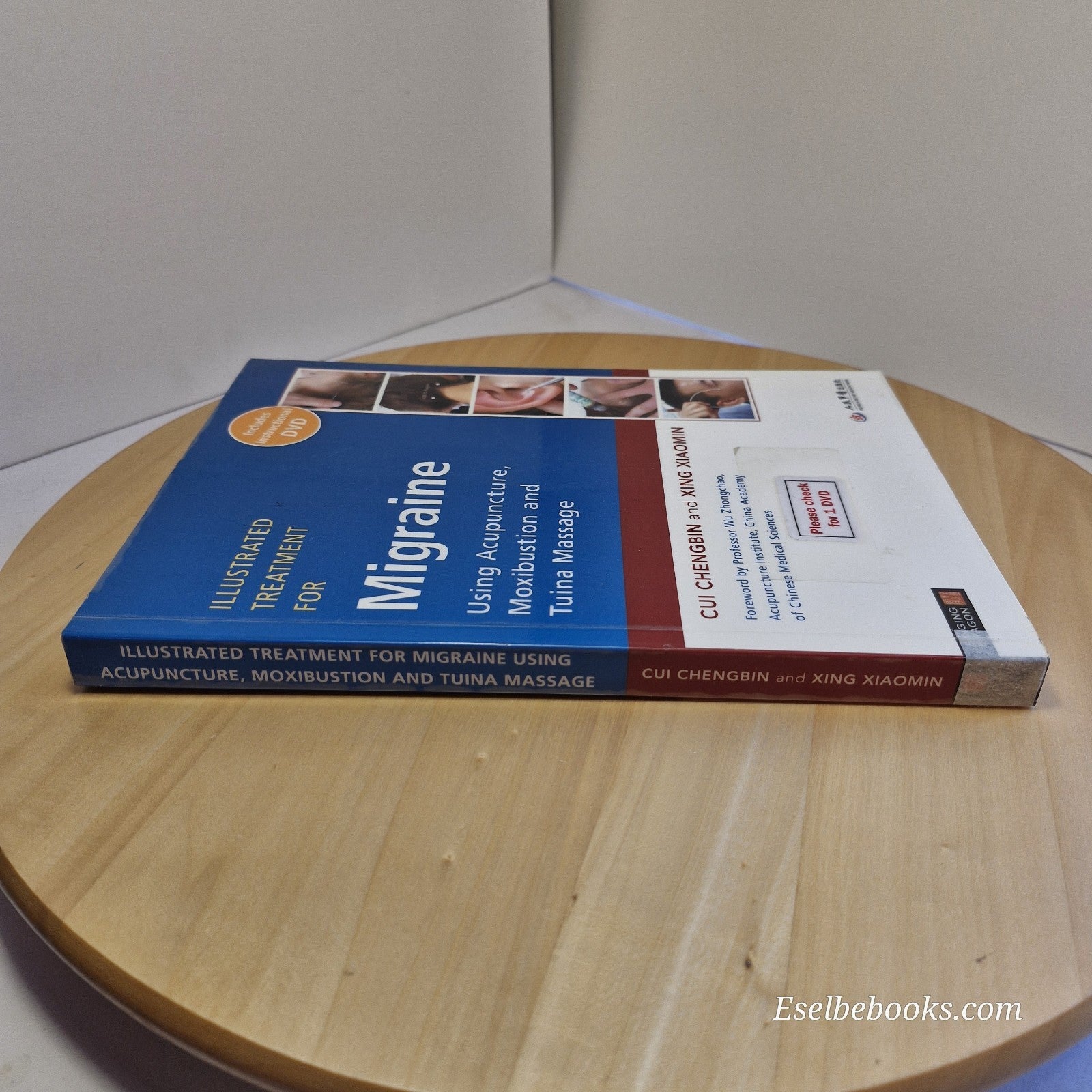 Illustrated Treatment for Migraine Using Acupuncture, Moxibustion and Tuina...