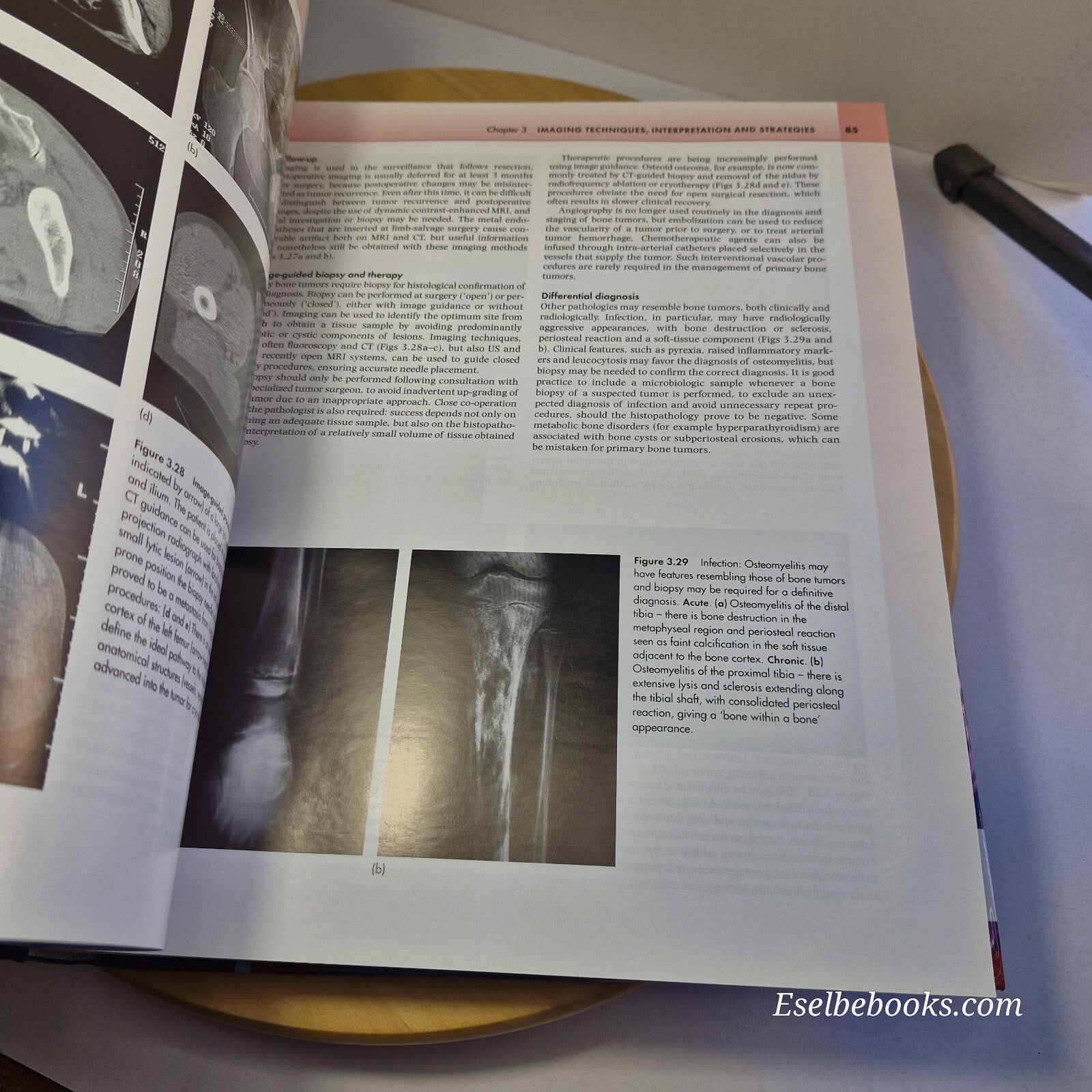 Orthopaedic Pathology 4th edition By Peter G. Bullough · 2004 - hardback