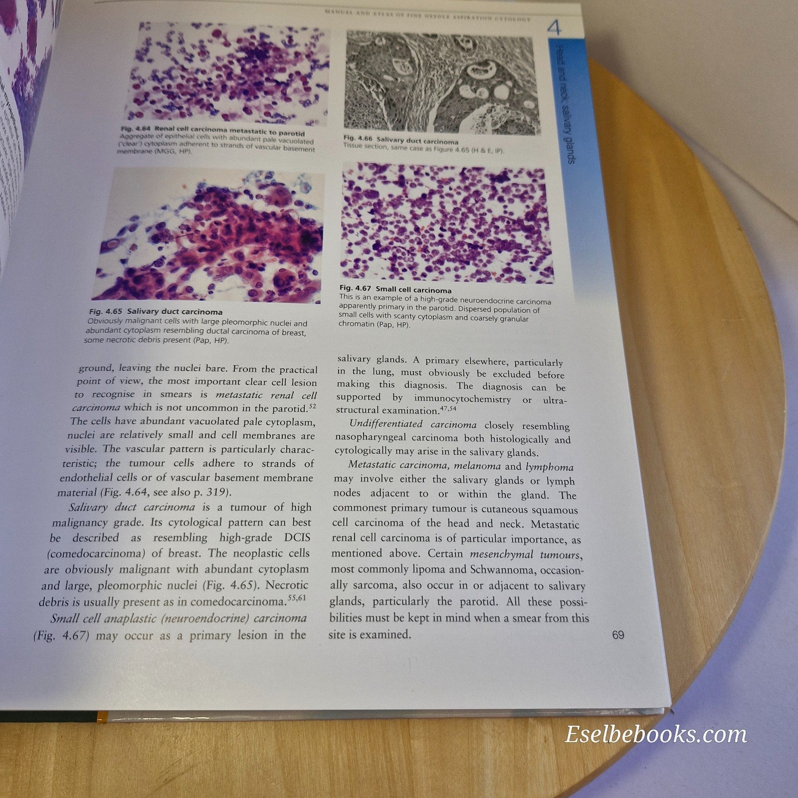 Manual & Atlas of Fine Needle Aspiration Cytology - Orell/Sterrett/Walters/Whita