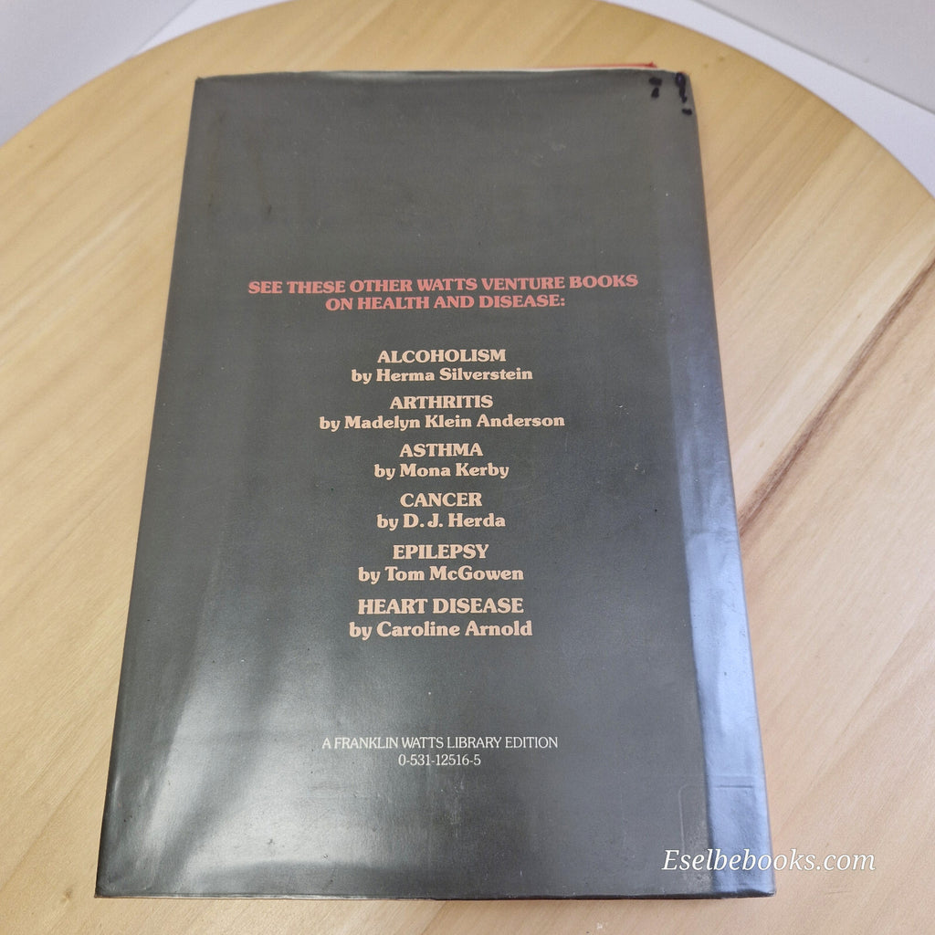 Health: 4 books about allergies and how to identify them - hardback/paperbacks