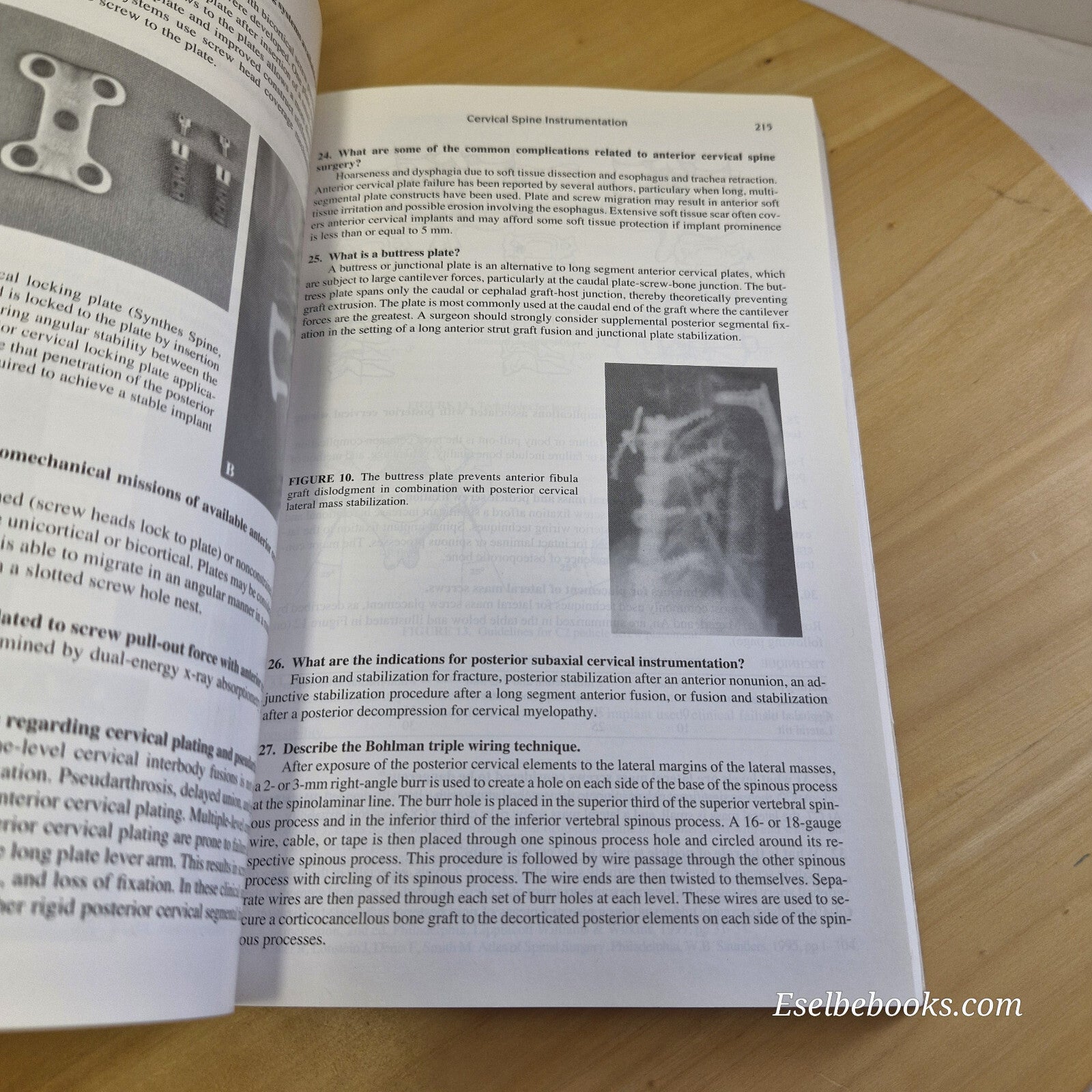 Spine Secrets By Vincent J. Devlin · 2003 - paperback