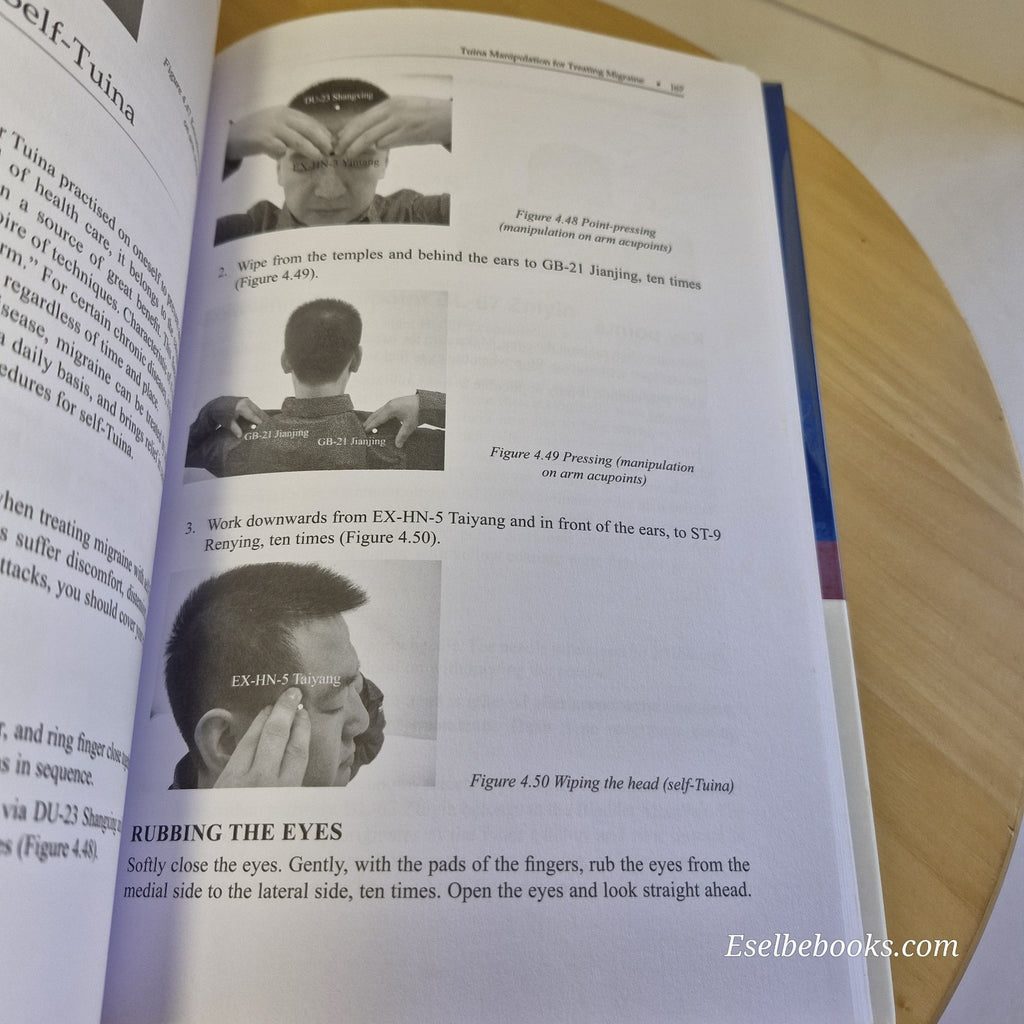 Illustrated Treatment for Migraine Using Acupuncture, Moxibustion and Tuina...