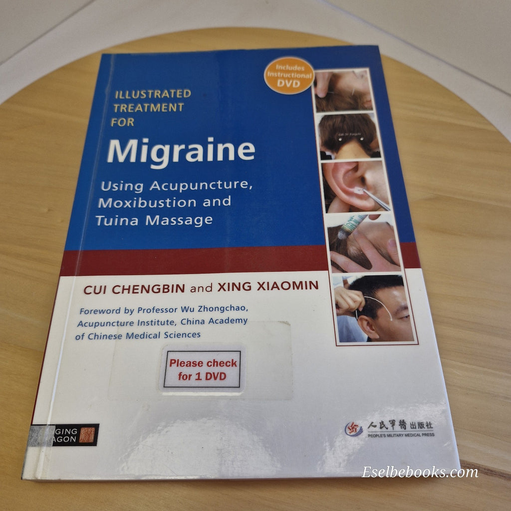 Illustrated Treatment for Migraine Using Acupuncture, Moxibustion and Tuina...