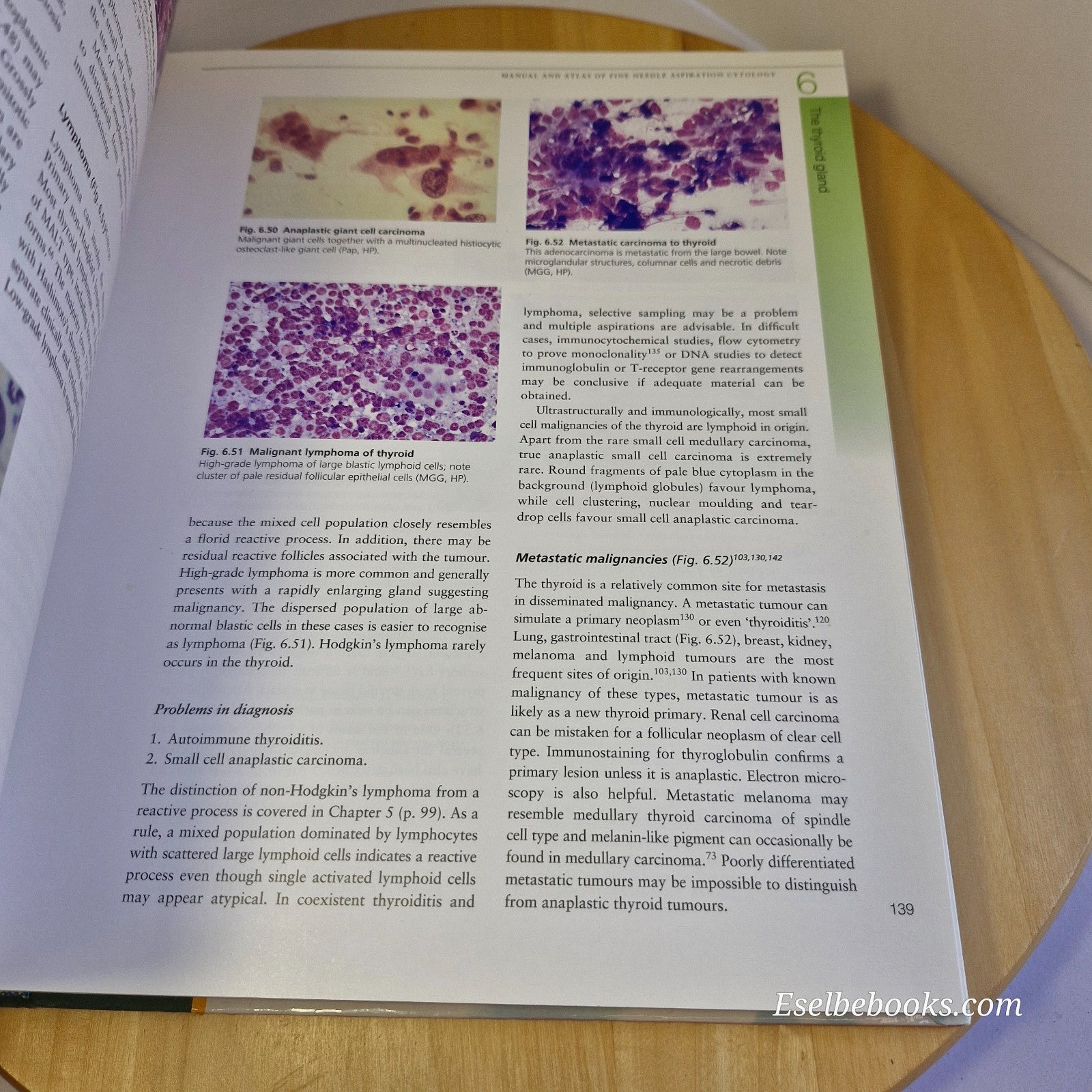 Manual & Atlas of Fine Needle Aspiration Cytology - Orell/Sterrett/Walters/Whita