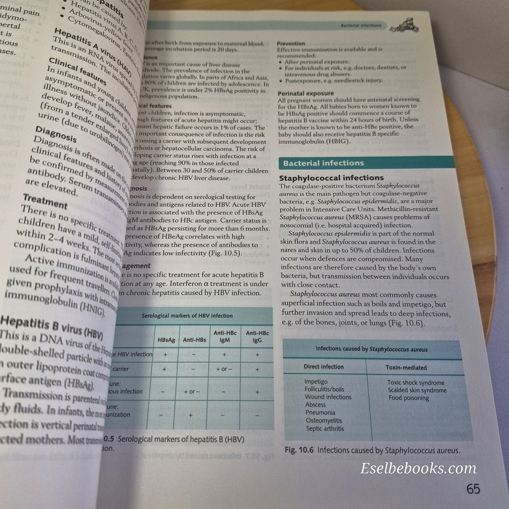 Paediatrics By David Pang, Tim Newson 2nd edition · 2005 - paperback