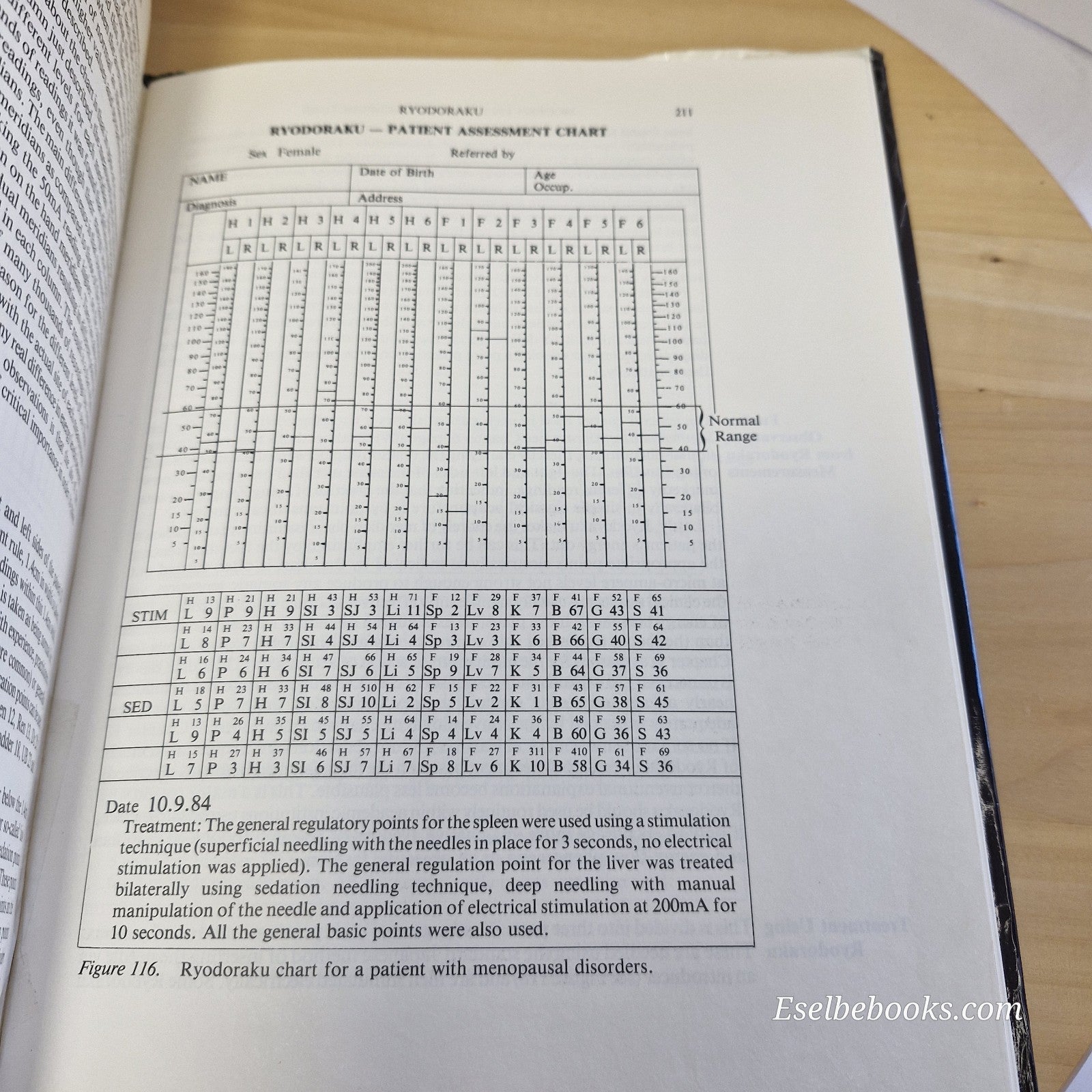 Modern Techniques of Acupuncture Volume 3 by Julian N Kenyon - hardback/dustjack