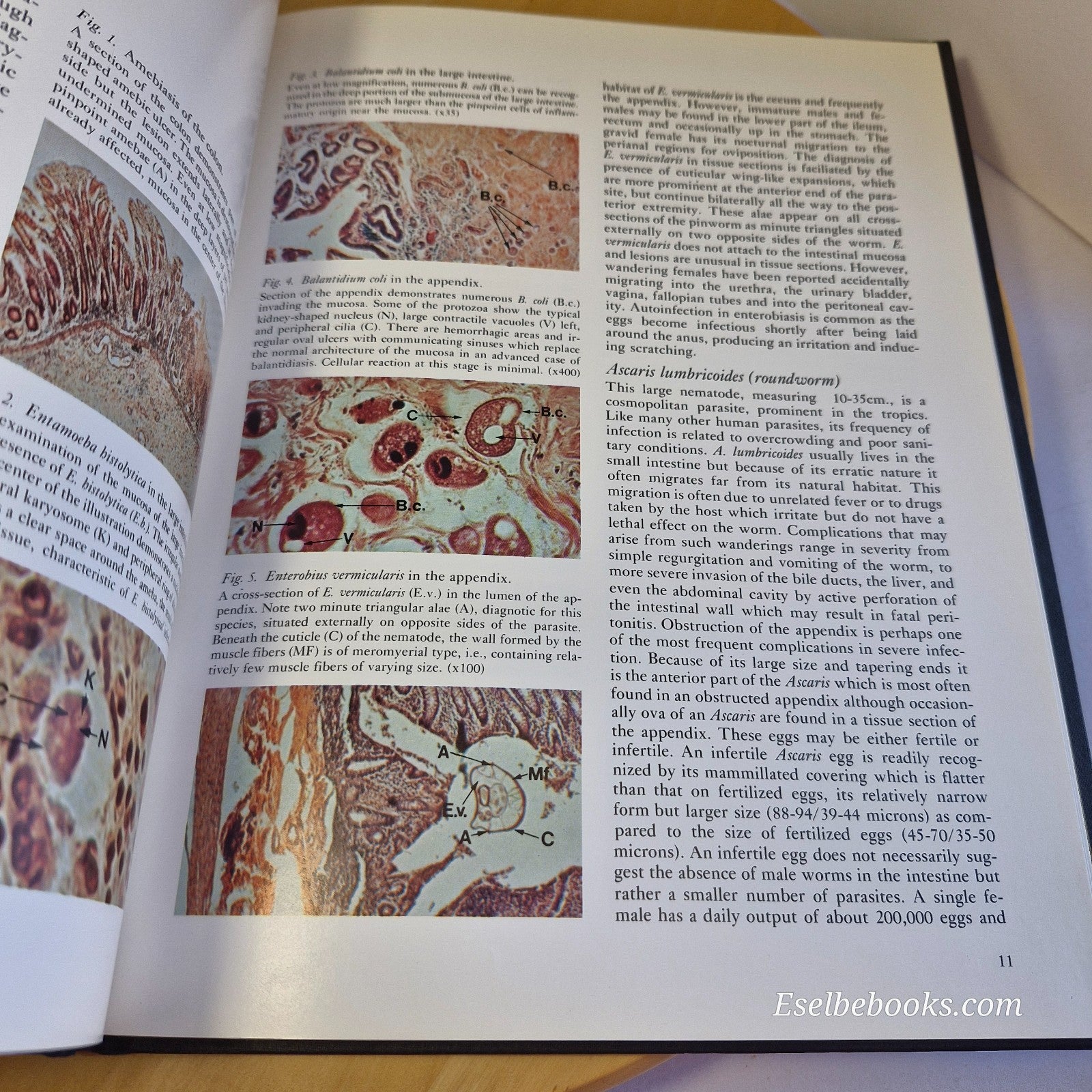 Scope Monograph on Pathoparasitology A Color Atlas by Michael Kenney - hardback