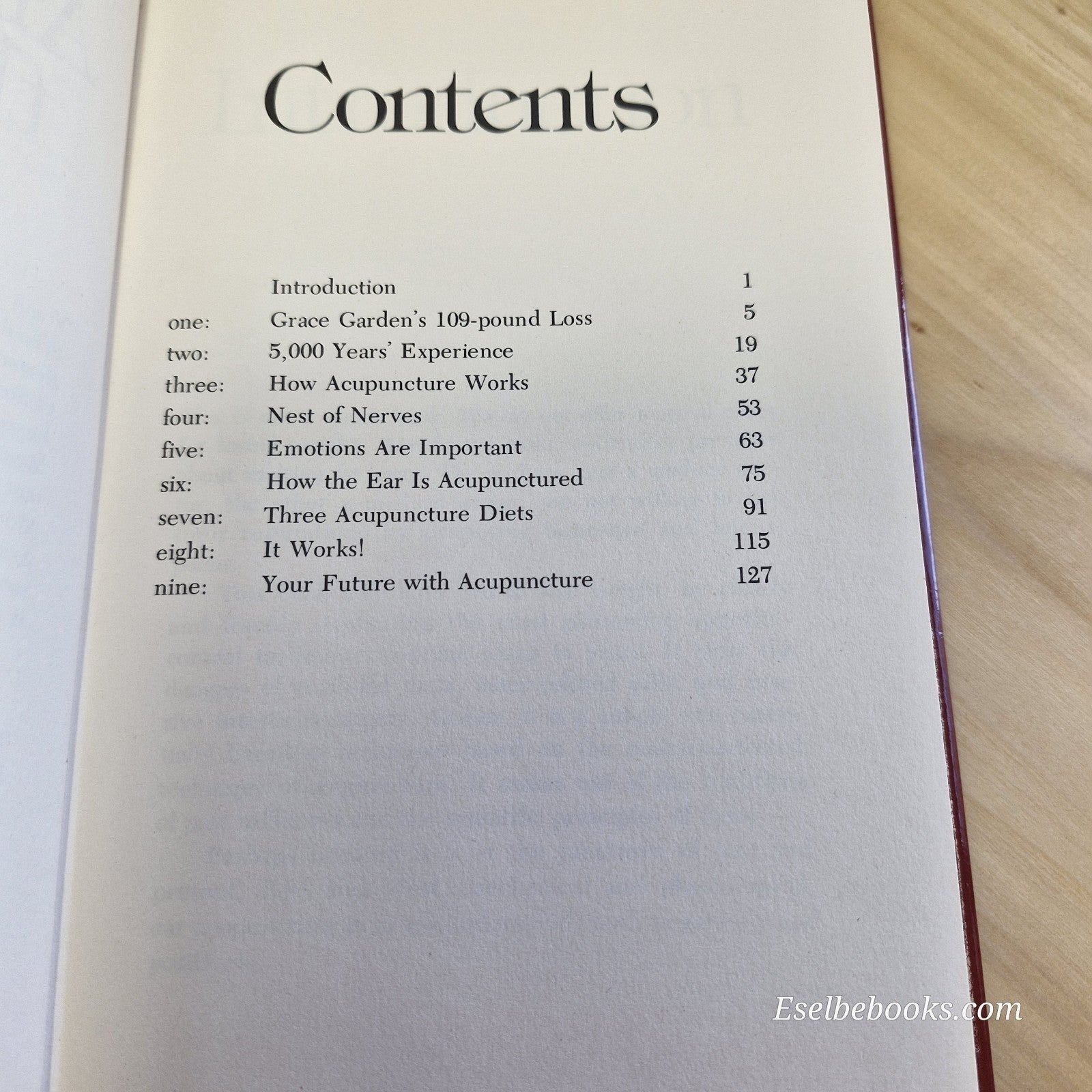 The Acupuncture Diet: Weight Loss & Ear Acupuncture by Frank Warren - hardback