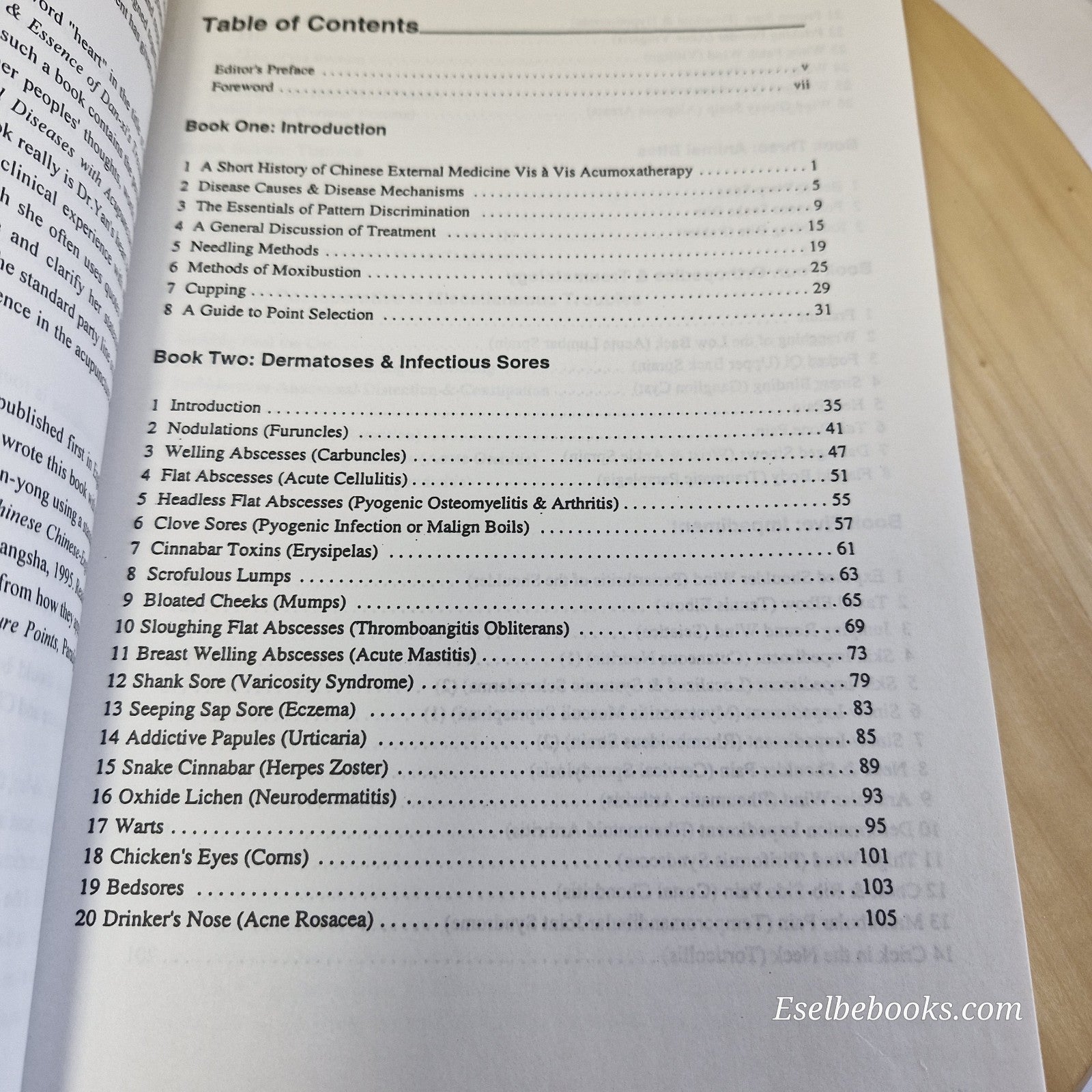 The Treatment of External Diseases with Acupuncture & Moxibustion by Yan Cui-Lan