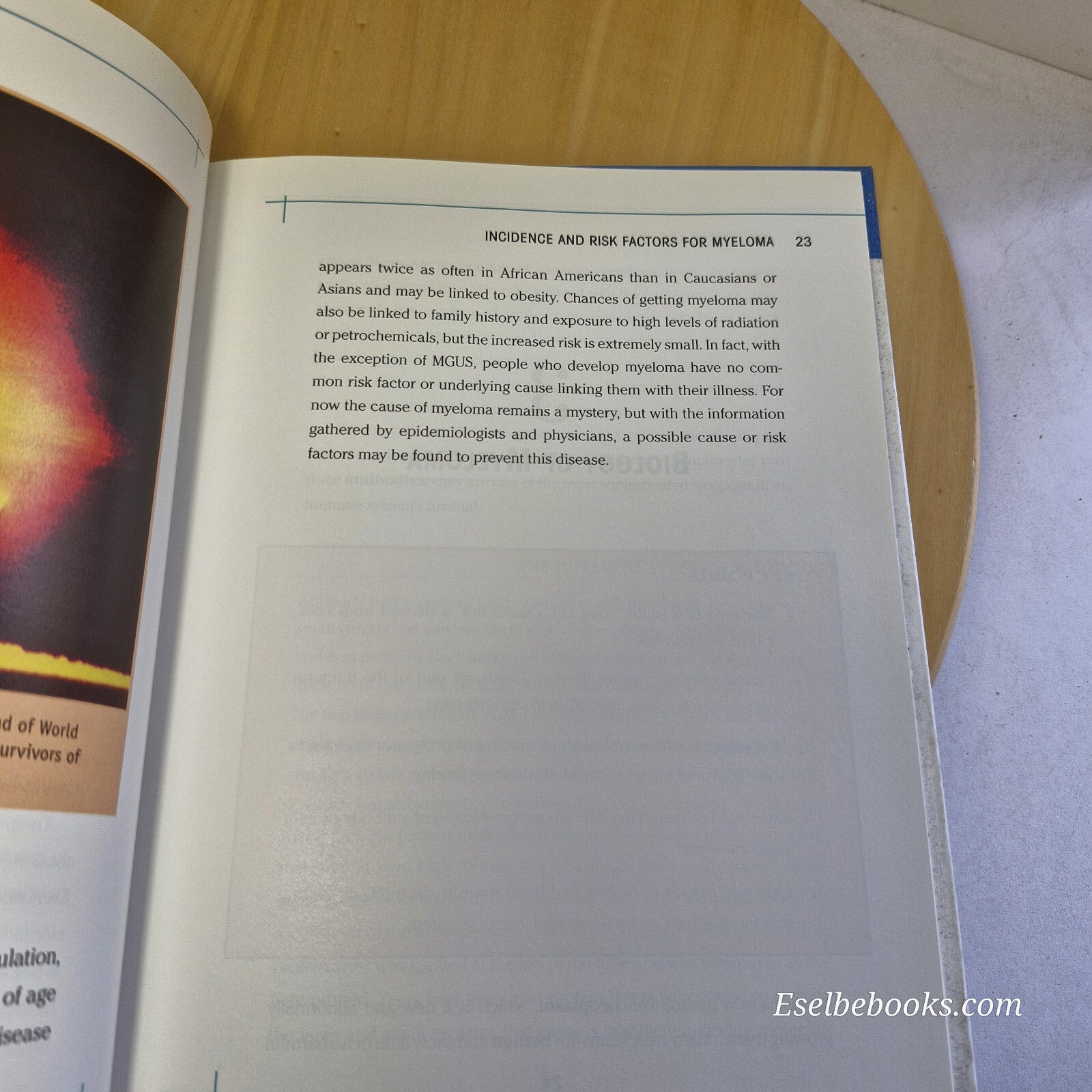 The biology of cancer - Myeloma by Jerome E Tanner - hardback