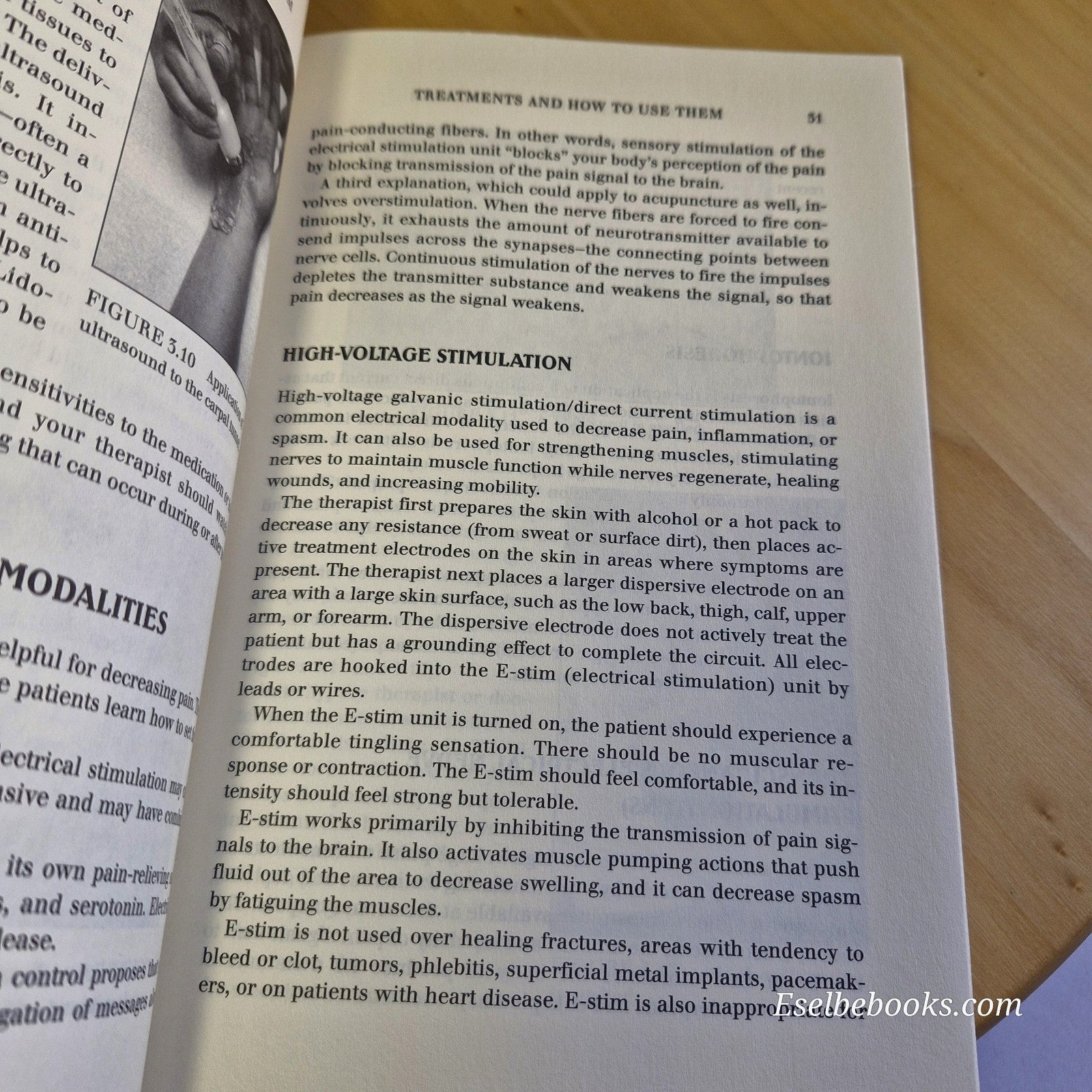 The Carpal Tunnel Helpbook: Self-Healing Alternatives by Scott M Fried