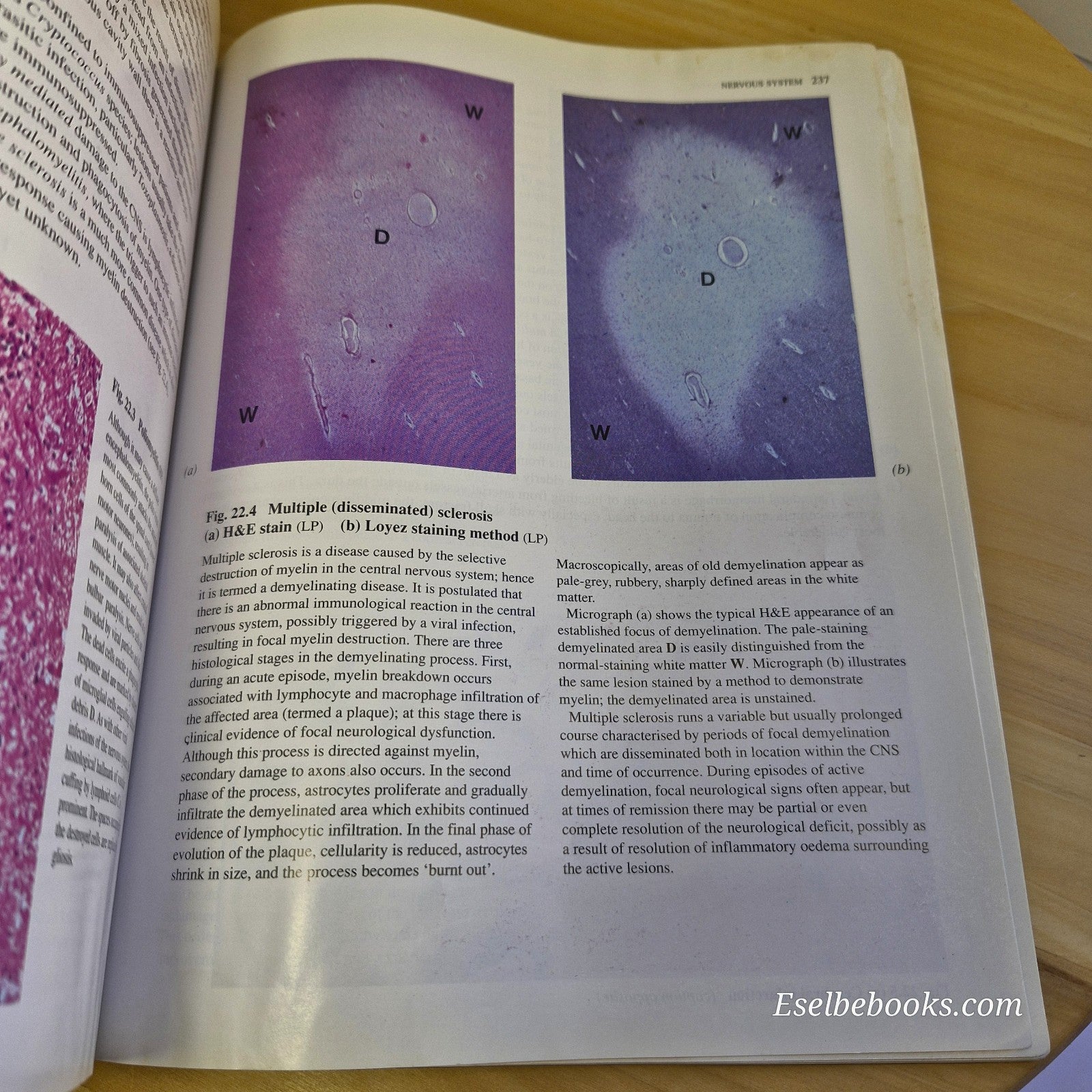 Wheater's Basic Histopathology A Colour Atlas and Text By Burkitt, Stevens, Lowe