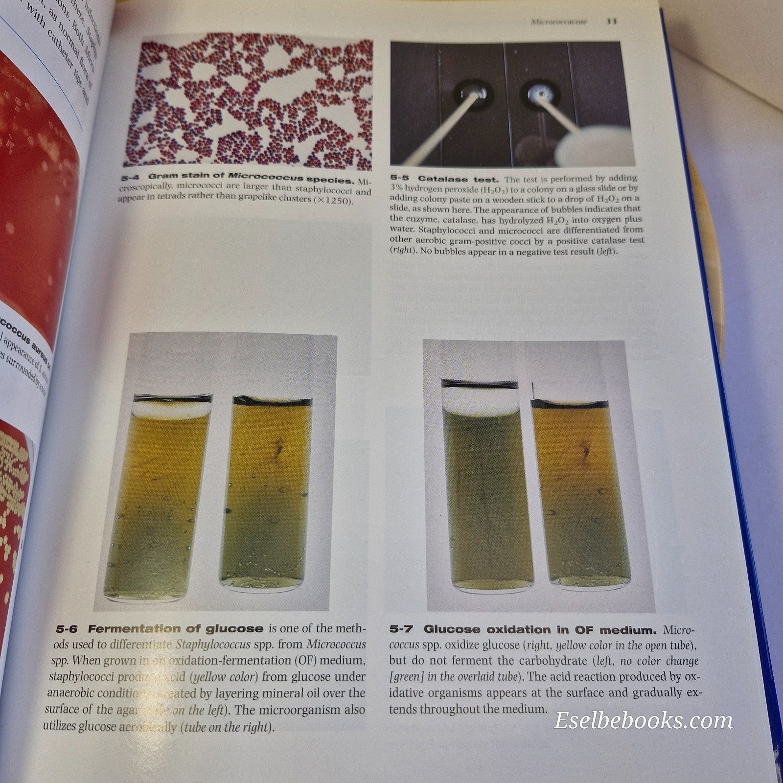 Color Atlas of Diagnostic Microbiology by E J Baron: L M De la Maza & M T Pezzlo