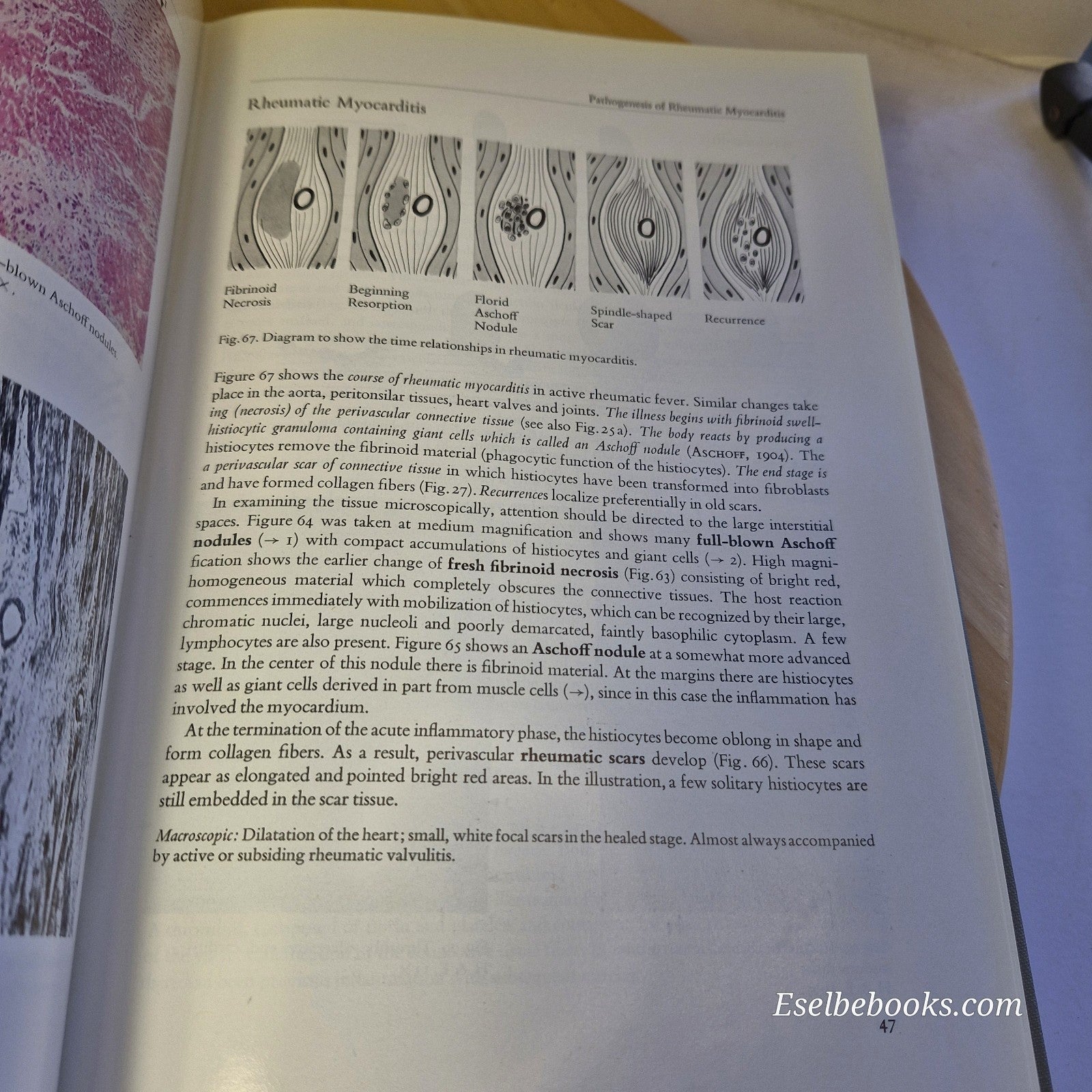 Color Atlas & Textbook of Tissue and Cellular Pathology By Sandritter & Wartman