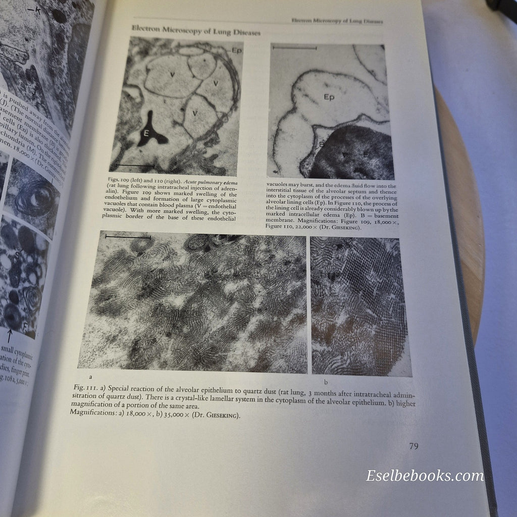 Color Atlas & Textbook of Tissue and Cellular Pathology By Sandritter & Wartman