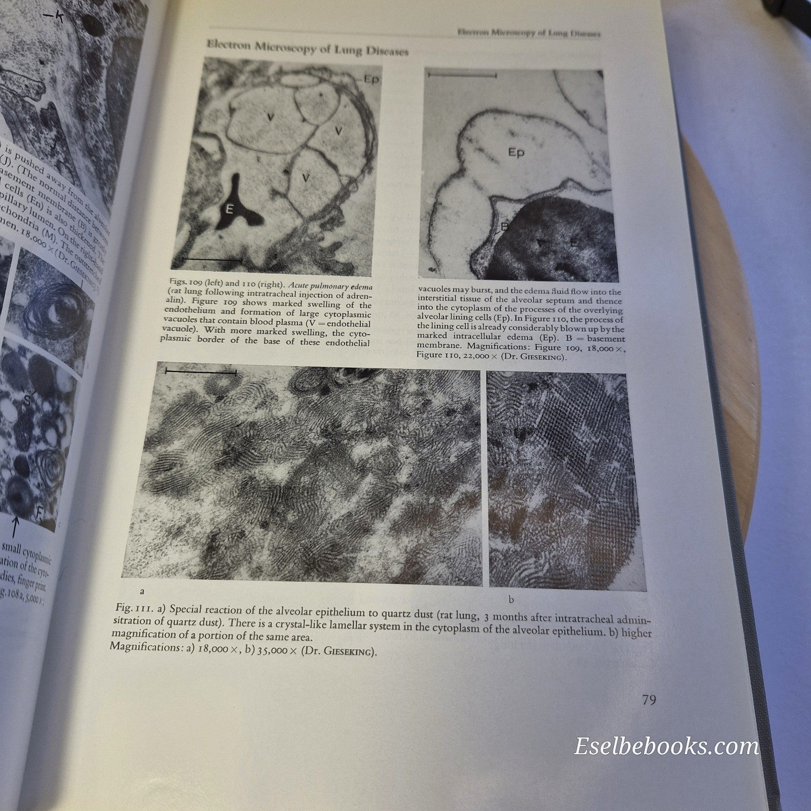 Color Atlas & Textbook of Tissue and Cellular Pathology By Sandritter & Wartman