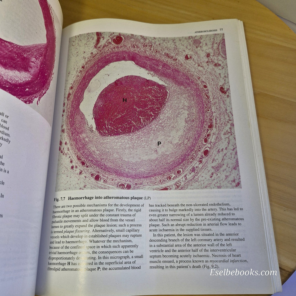 Wheater's Basic Histopathology A Colour Atlas and Text By Burkitt, Stevens, Lowe