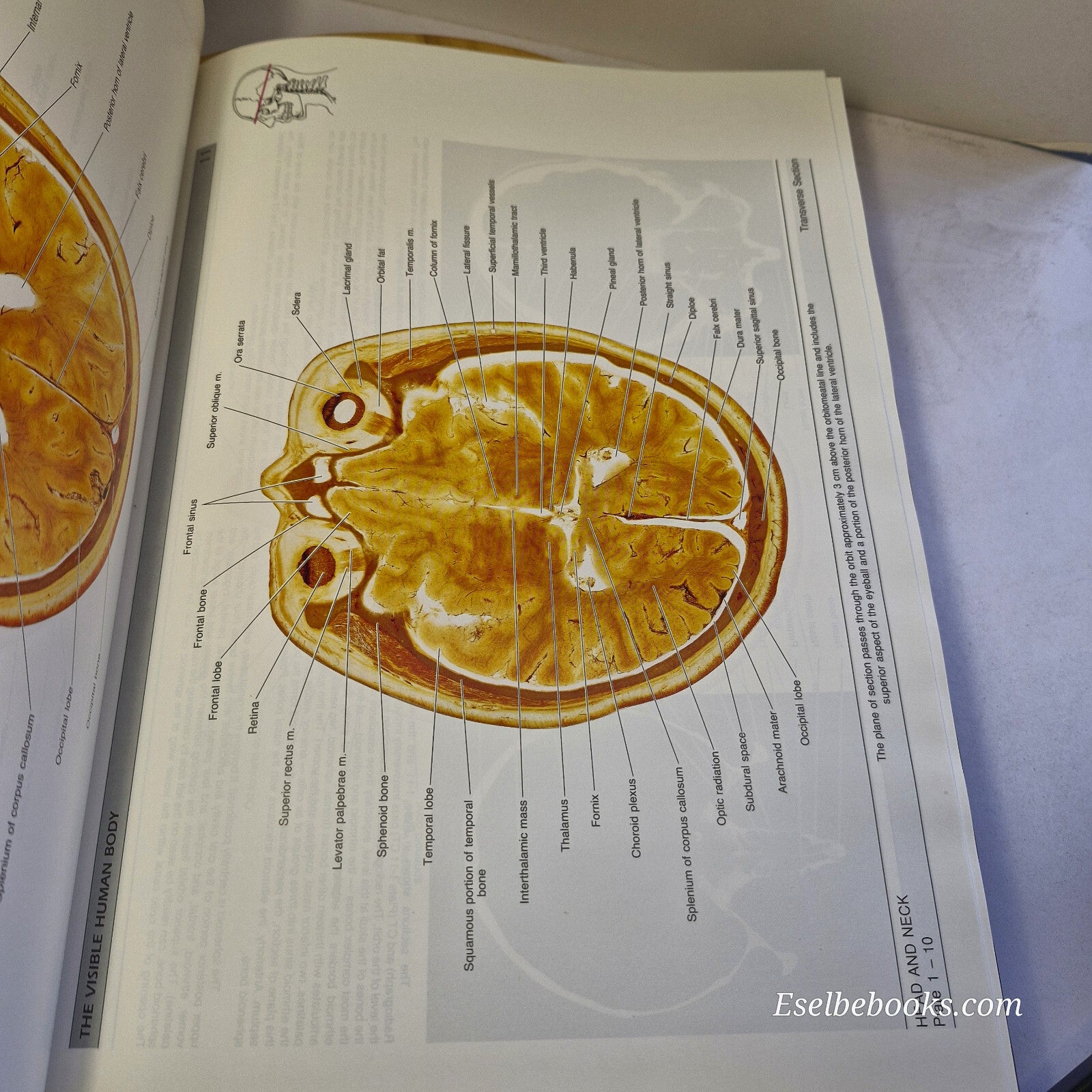 The Visible Human Body An Atlas of Sectional Anatomy By Gunther von Hagens · ...