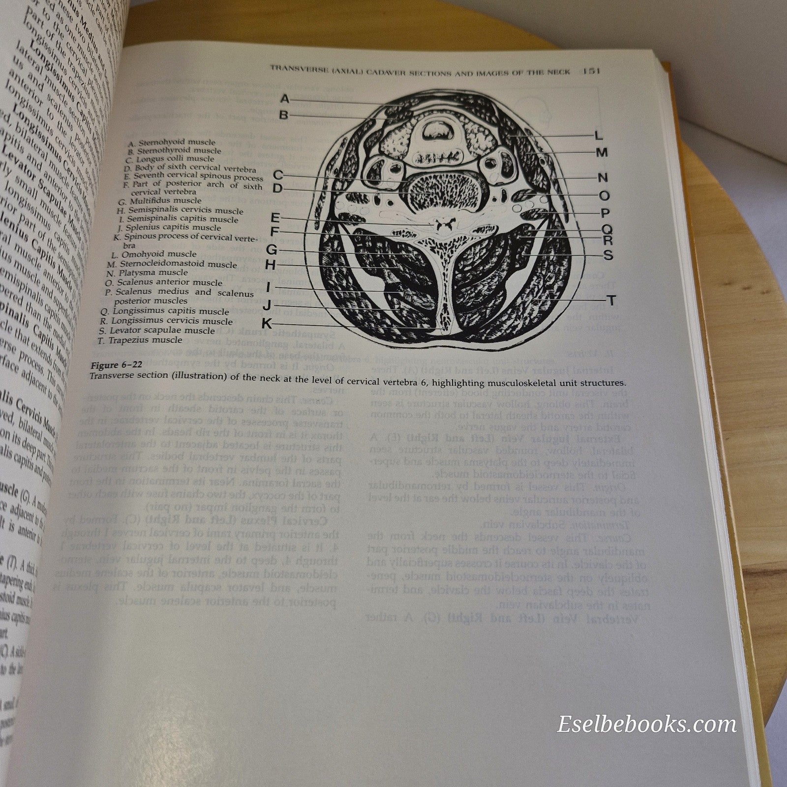 Modern Sectional Anatomy By Alexander Lane & Hossein Sharfaei · 1992 - hardback
