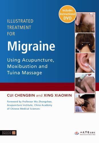 Illustrated Treatment for Migraine Using Acupuncture, Moxibustion and Tuina...